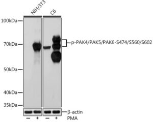 Phospho-PAK4/PAK5/PAK6-S474/S560/S602 Rabbit mAb