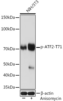 Phospho-ATF2-T71 Rabbit mAb