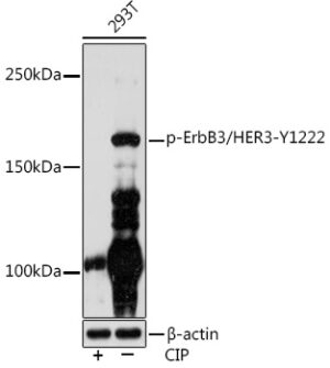 Phospho-ErbB3/HER3-Y1222 Rabbit mAb