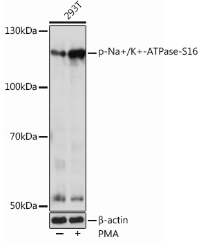 Phospho-Na+/K+-ATPase-S16 Rabbit pAb
