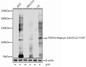Phospho-PSD93/chapsyn-110/DLG2-Y340 Rabbit pAb