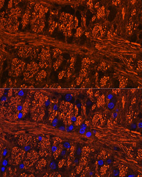 Phospho-Tau-Ser404 Rabbit pAb