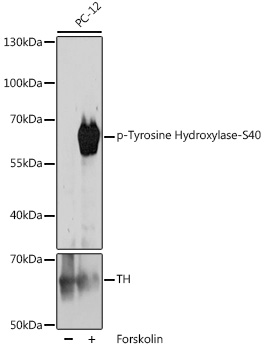 Phospho-Tyrosine Hydroxylase-S40 Rabbit pAb