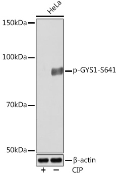 Phospho-GYS1-S641 Rabbit mAb