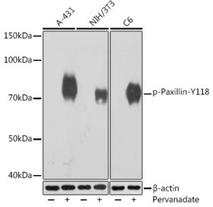 Phospho-Paxillin-Y118 Rabbit mAb