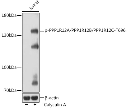 Phospho-PPP1R12A/PPP1R12B/PPP1R12C-T696 Rabbit pAb