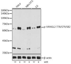Phospho-VANGL2-T78/S79/S82 Rabbit mAb