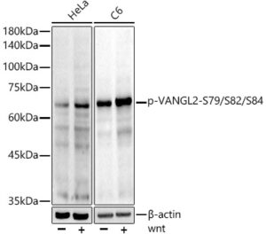 Phospho-VANGL2-S79/S82/S84 Rabbit mAb