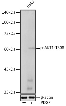 Phospho-AKT1-T308 Rabbit pAb