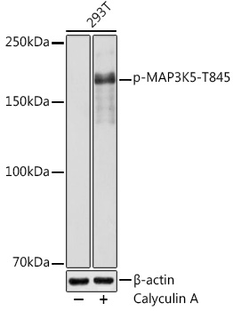 Phospho-MAP3K5-T845 Rabbit pAb