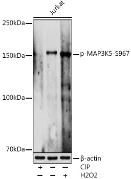 Phospho-MAP3K5-S967 Rabbit pAb