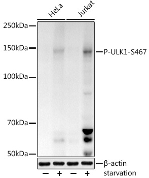 Phospho-ULK1-S467 Rabbit pAb