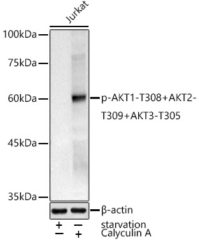 Phospho-AKT1-T308+AKT2-T309+AKT3-T305 Rabbit pAb