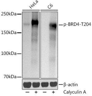 Phospho-BRD4-T204 Rabbit mAb