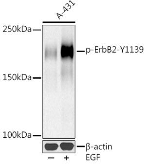 Phospho-HER2/ErbB2-Y1139 Rabbit mAb