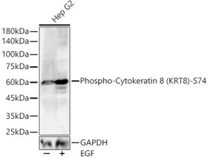 Phospho-Cytokeratin 8 (KRT8)-S74 Rabbit pAb