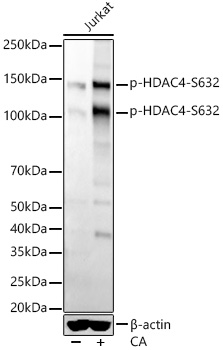 Phospho-HDAC4-S632 Rabbit mAb