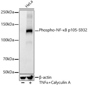 Phospho-NF-κB p105-S932 Rabbit mAb