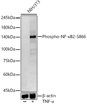 Phospho-NF-κB2-S866 Rabbit mAb