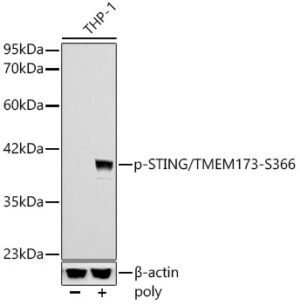 Phospho-STING/TMEM173-S366 Rabbit mAb