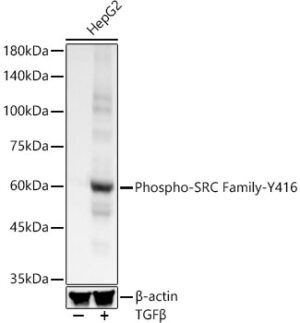 Phospho-SRC Family-Y416 Rabbit mAb
