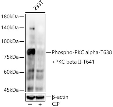 Phospho-PKC alpha-T638 + PKC beta II-T641 Rabbit mAb