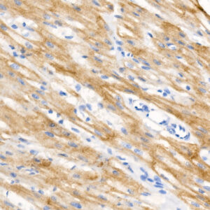 Phospho-Cardiac Troponin I (TNNI3)-S23/S24 Rabbit mAb
