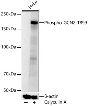 Phospho-GCN2-T899 Rabbit pAb