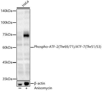 Phospho-ATF-2 (Thr69/71)/ATF-7 (Thr51/53) Rabbit pAb
