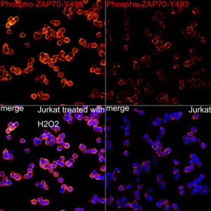 Phospho-ZAP70-Y493 Rabbit mAb