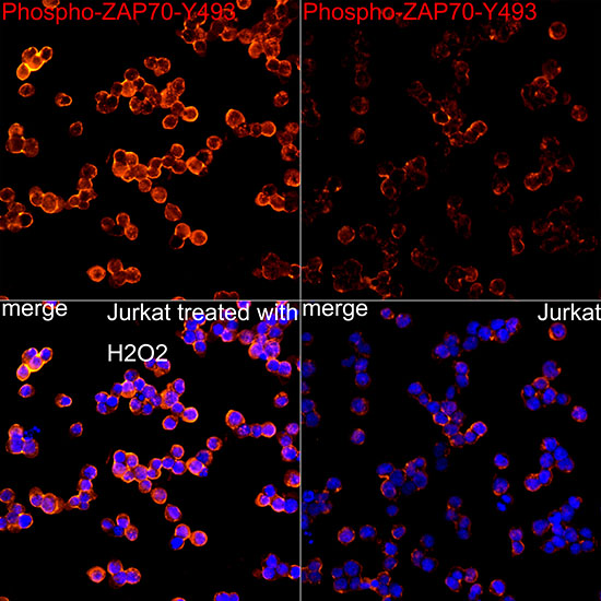 Phospho-ZAP70-Y493 Rabbit mAb