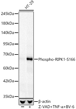 Phospho-RIPK1-S166 Rabbit mAb