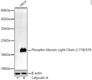 Phospho-Myosin Light Chain 2-T18/S19 Rabbit mAb