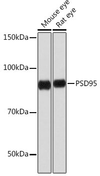 PSD95 Rabbit mAb