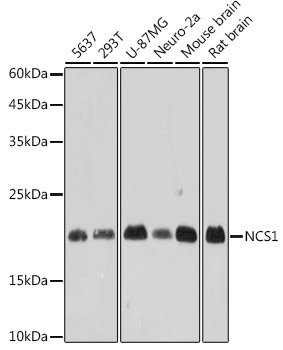 NCS1 Rabbit mAb