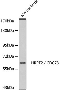HRPT2 / CDC73 Rabbit pAb