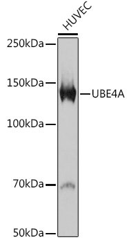 UBE4A Rabbit mAb