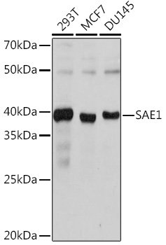 SAE1 Rabbit mAb