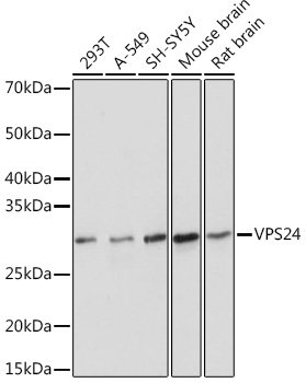 VPS24 Rabbit mAb