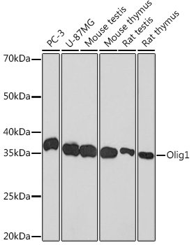 Olig1 Rabbit mAb