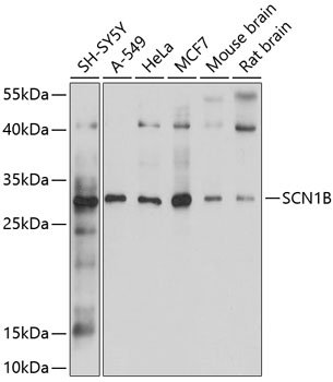 SCN1B Rabbit pAb