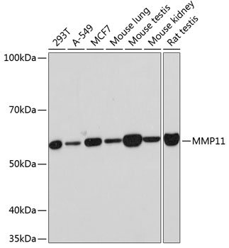MMP11 Rabbit mAb