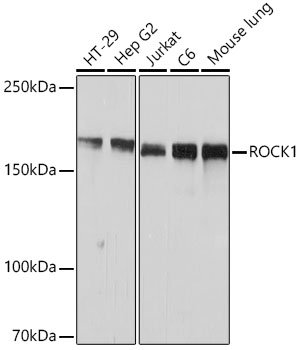 ROCK1 Rabbit mAb