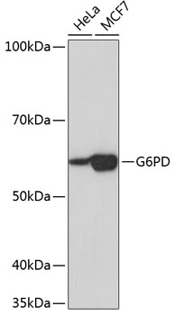 G6PD Rabbit mAb