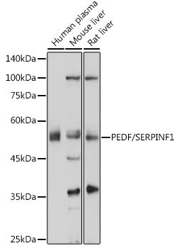 PEDF/SERPINF1 Rabbit pAb