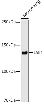 JAK1 Rabbit mAb