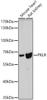 PKLR Rabbit pAb