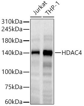 HDAC4 Rabbit mAb