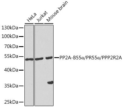PP2A-B55α/PR55α/PPP2R2A Rabbit pAb