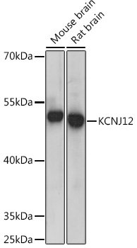 KCNJ12 Rabbit pAb
